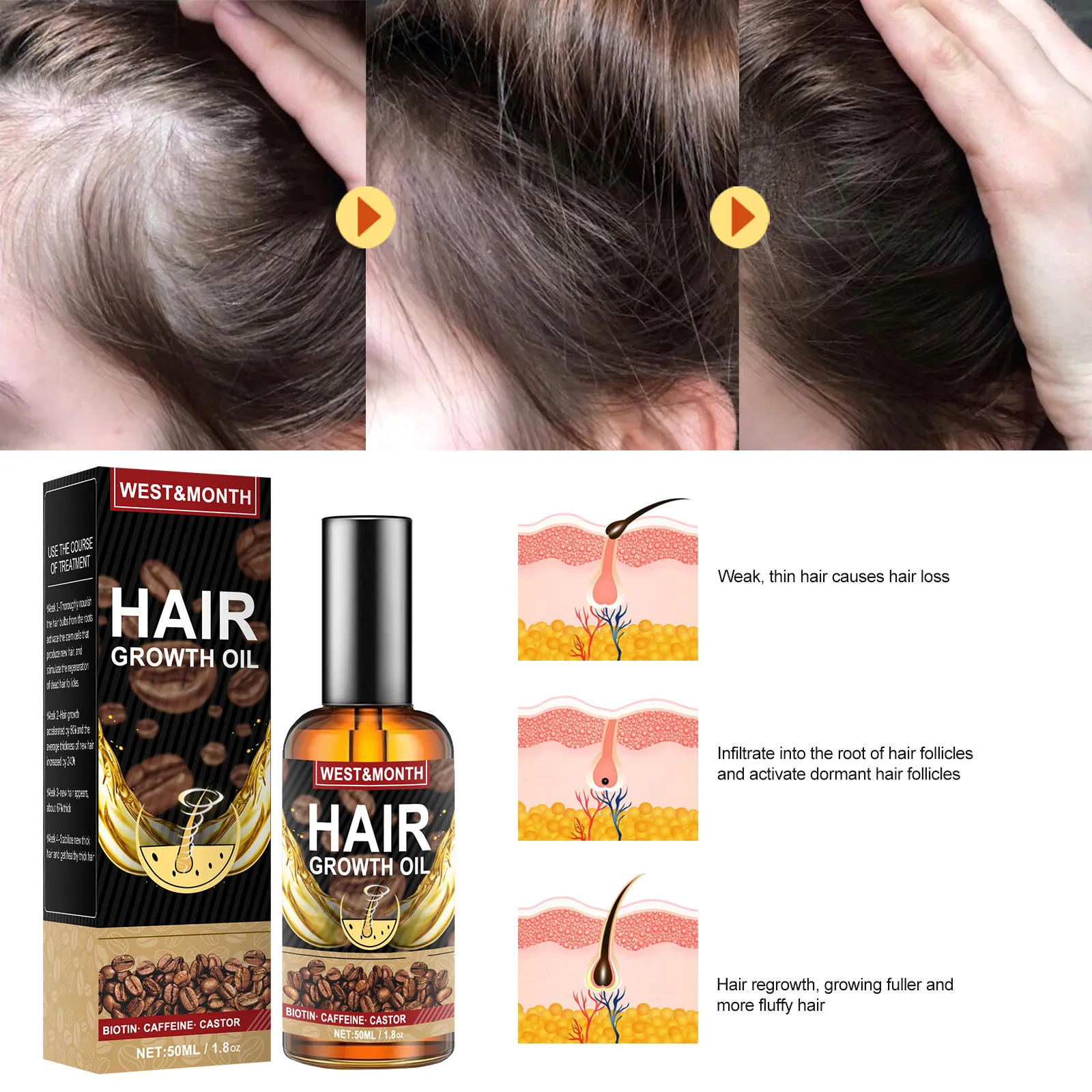 BUY 1 TAKE 1】WEST&MONTH Caffeine Hair Thick Anti Hair Loss Essential oil  Hair essential oil Hair Growth Essence Prevents Hair Loss Rapid hair growth  Strong roots, restore hair, protect your hair Hair