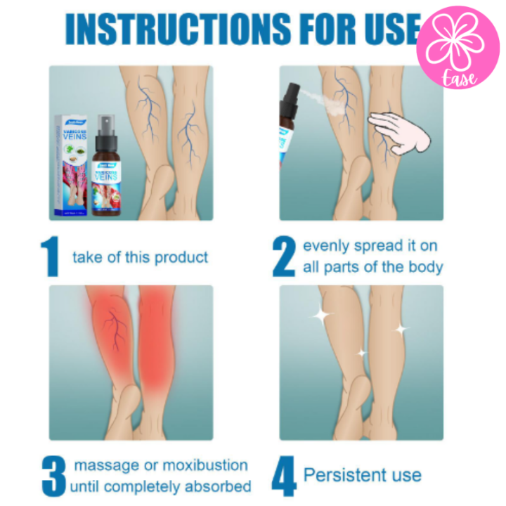 varicose-veins-spray-ทรีทเม้นท์นวดบรรเทาอาการเส้นเลือดขอด-สเปรย์ฉีดเส้นเลือดขอด-ขนาด-30-ml