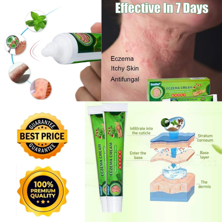 Eczema cream is a topical product designed to provide relief and manage ...