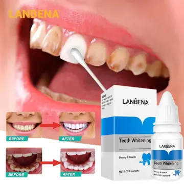 Shop Whiten Remove Yellow Teeth Hunmlii with great discounts and prices  online - Jan 2024