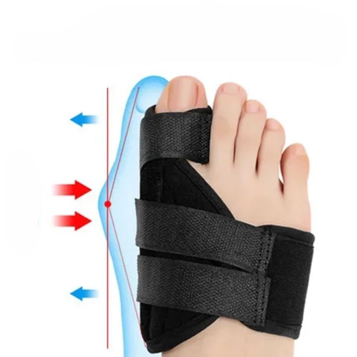 chasers-กลางแจ้ง-store-เท้าแก้ไขหัวแม่มือเบี้ยวเข็มขัดที่รองปุ่มหัวแม่เท้าที่คั่นนิ้วเท้าการแก้ไขข้อต่อดูแลเท้าเท้า-orthotics-นิ้วเท้านุ่มแขน