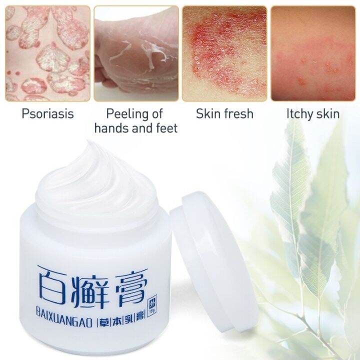 ♞HERBAL For PSORIASIS and ECZEMA BaiXuanGao Advance Natural Herbal