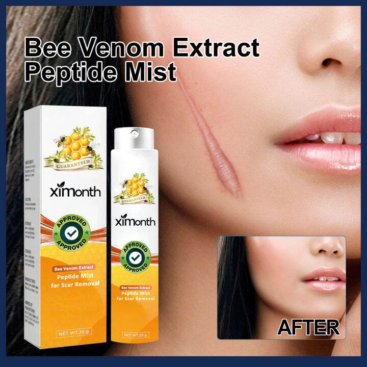 XiMonth Bee Venom Extract Peptide Mist Scar Removal Spray Repaire Old ximonth-bee-venom-extract-peptide-mist-scar-removal-spray-repaire-old