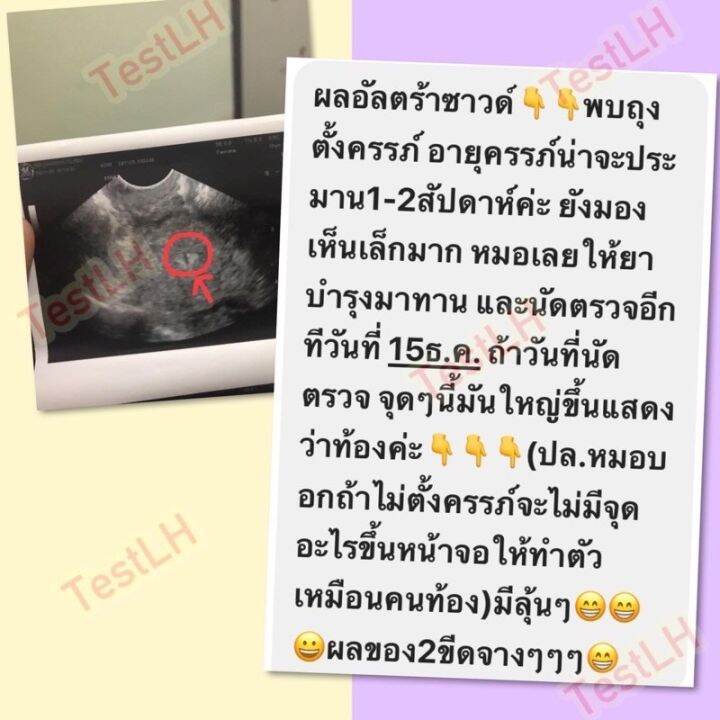 ที่ตรวจไข่ตก-10ชิ้น49บาทค่ะ-ไข่ตก-ตกไข่-ovulation-ตรวจไข่ตก-อยากมีลูก-อยากมีบุตร