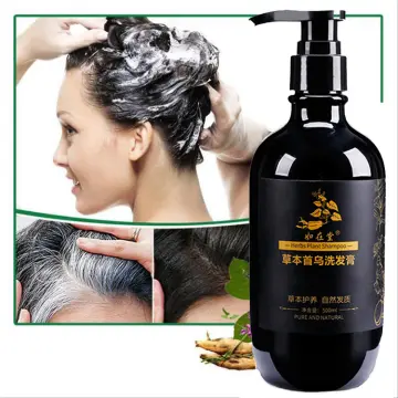 แก้ปัญหาผมหงอก ราคาถูก ซื้อออนไลน์ที่ - ก.ค. 2023 | Lazada.co.th แก้ปัญหาผมหงอก ราคาถูก ซื้อออนไลน์ที่ - ก.ค. 2023 | Lazada.Co.Th