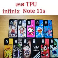 เคส TPU infinix NOTE 11S  เคสกันกระแทก Note11S ลายการ์ตูน น่ารัก เคสโทรศัพท์มือถือ infinix note11S