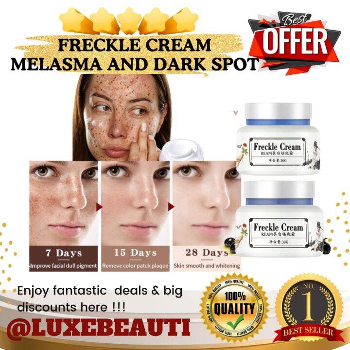 Effective Freckle Cream Melasma and Dark spot remover whipped cream anti melasma cream face