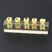 Dental Endodontic Treatment Demonstration Model 4012 Study Teach Teeth Model