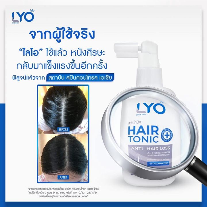 แพ็ค-6-ขวด-ไลโอ-แฮร์โทนิค-100-ml-ยาสระผม-เซรั่มบำรุงผม-ลดผมร่วง-เพิ่มผมหนา-ผมดกดำ-ขจัดรังแค-ชะลอผมหงอก