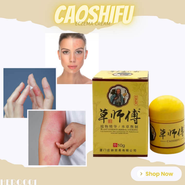 Best Selling Caoshifu Eczema Psoriasis Treatment Cream Topical Medicated Chinese Traditional 