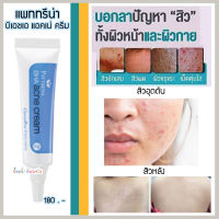 ครีมแต้ม สิวอุดตัน สิวไม่มีหัว สิวหลัง แพททรีน่า บีเอชเอ แอคเน่ ครีม Pattrena BHA Acne Cream Giffarine