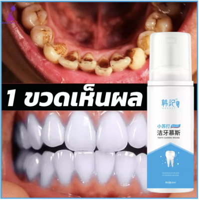 ยาสีฟันฟันขาว ฟอกฟันขาว ฟันขาว มูสฟันขาว ง่ายและสะดวกในการดูแลสุขภาพเหงือก ป้องกันฟันผุ ดับกลิ่นปาก มูสแปรงฟัน