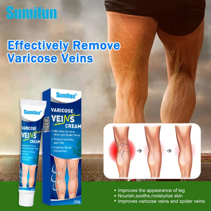 【SUMIFUN】Varicose Veins Remover Treatment Cream Spider Vein Pain