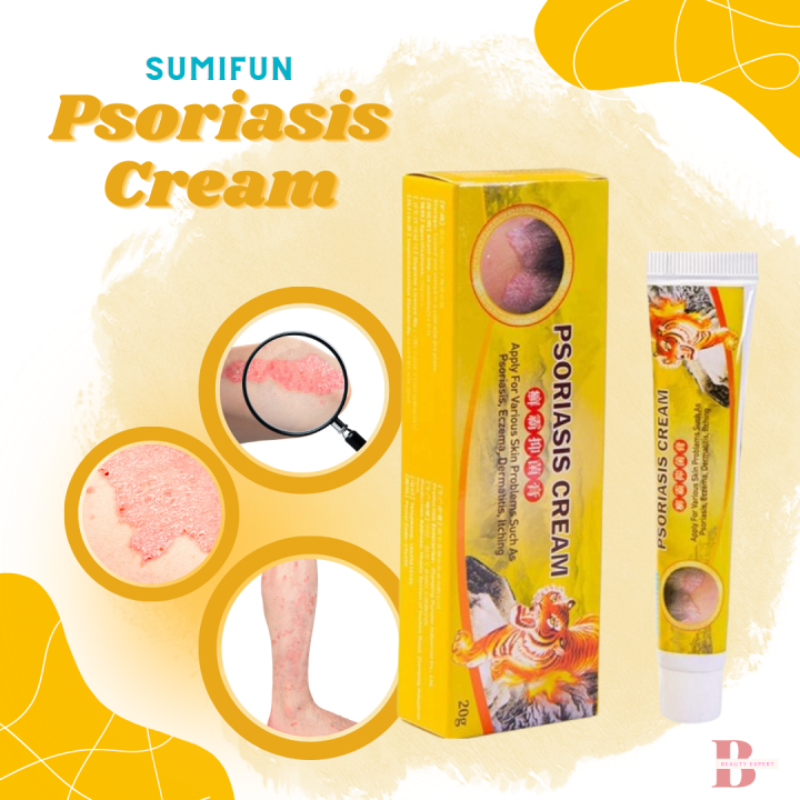 Sumifun Psoriasis Eczema Treatment Cream antibacterial cream 20g