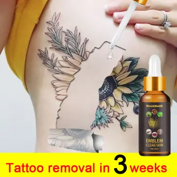 How To Fade A Tattoo In 2024: You Need To Know This! — InkMatch