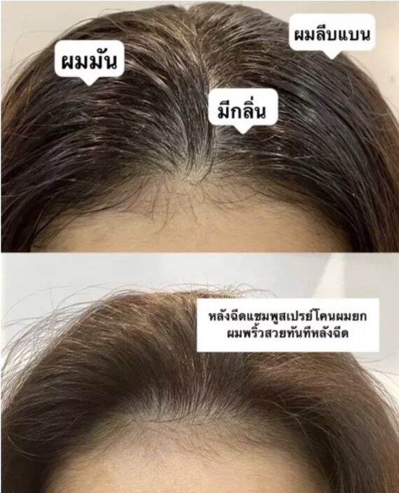 สเปรย์ฉีดผมแห้ง-150ml-สเปรย์สระผม-สเปรย์สระแห้ง-แก้ผมมัน-ไม่ต้องล้างออก-สเปรย์-สระผม-แห้ง-ผม-สวยใน-5-นาที-ผมดูหนาขึ้น