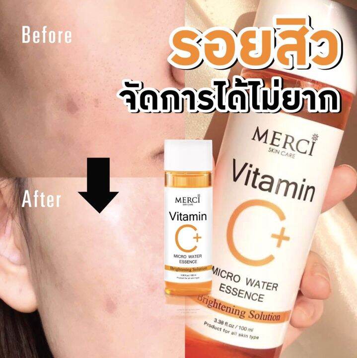 ใหม่-แท้-จากบริษัทโดยตรง-น้ำตบวิตซี-เมอร์ซี่-merci-vitamin-c-essence-100ml-น้ำตบสยบสิว