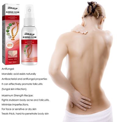 【UClanka】Body Clearing Serum Spray Clearing Serum For Back Butt Chest Thighs Shoulders Face Armpits Ac-ne Folliculitis Bumps Pimples