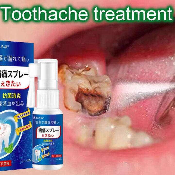 100 Effective Toothache Spray 20ml 30s Fast Pain Relief Plant Extracts Hormone Free Wisdom