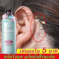 【ซื้อ 2 แถม 1】ยาสระผมแก้ปัญหาเส้นผม แชมพูรักษารังแคถาวร ขจัดรังแคแก้เชื้อรา  คุมความมันลดผมร่วง หนังศรีษะสดชื่น ผมนุ่มสลวยแข็งแรง 500 ml