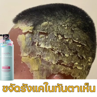 シャンプ แชมพูขจัดรังแค 500ml ควบคุมความมันและรังแคแก้ปัญหาเช่นหัวมันรังแคแห้งและคันจากรากของหนังศีรษะ