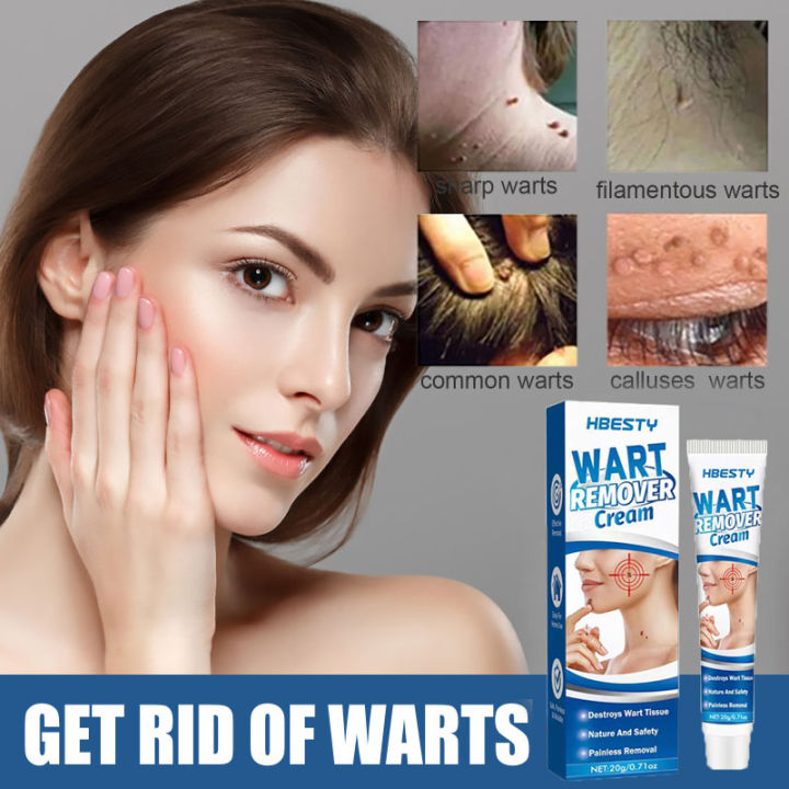 Wart Removal Liquid West Month Tags Moles Remover Pen Mole Remover Tags 