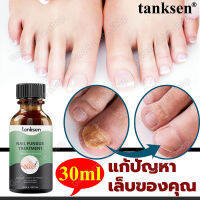 บอกลา เล็บเสีย!! tanksen เซรั่มบำรุงเล็บ 30ml เชื้อราเล็บมือ แก้ไขเชื้อราเล็บ ทาเชื้อราที่เล็บ ดูแลเล็บ น้ำมันบำรุงเล็บ เอ็สเซ้น ซ่อมแซมเล็บเสีย เชื้อราที่เล็บ เซรั่มทาเชื้อราที่เล็บ เซรั่มกันเชื้อราเล็บ เซรั่มซ่อมแซมเล็บ ครีมบำรุงเล็บ Nail Repair Essence