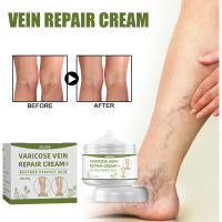 Varicose Veins Cream สำหรับทาเส้นเลือดขอด เป็นยาทาเส้นเลือดขอดที่ช่วยส่งเสริมการไหลเวียนเลือดบรรเทาอาการบวมชา 50 กรัม