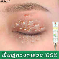 【ซื้อ 2 แถม 1】【มีสินค้าพร้อมจัดส่ง】Aichun ครีมบำรุงรอบตา ครีมทาตาดำ เม็ดไขมัน 30ml (ขอบตาดำ ครีมทารอบดวงตา รอยตีนกา ครีมลดรอยตีนกา บำรุงสายตา ครีมลดริ้วรอบดวงตา ครีมทาตาเม็ดไขมัน เซรั่มอายครีม เซรั่มทาถุงใต้ตา เซรั่มถุงใต้ตา ครีมไต้ตา)