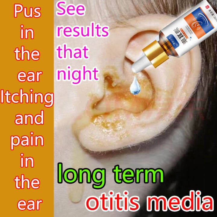 Ear drops for itchy ears, for ear infection treatment, medication antibacterial,Spot Treatments