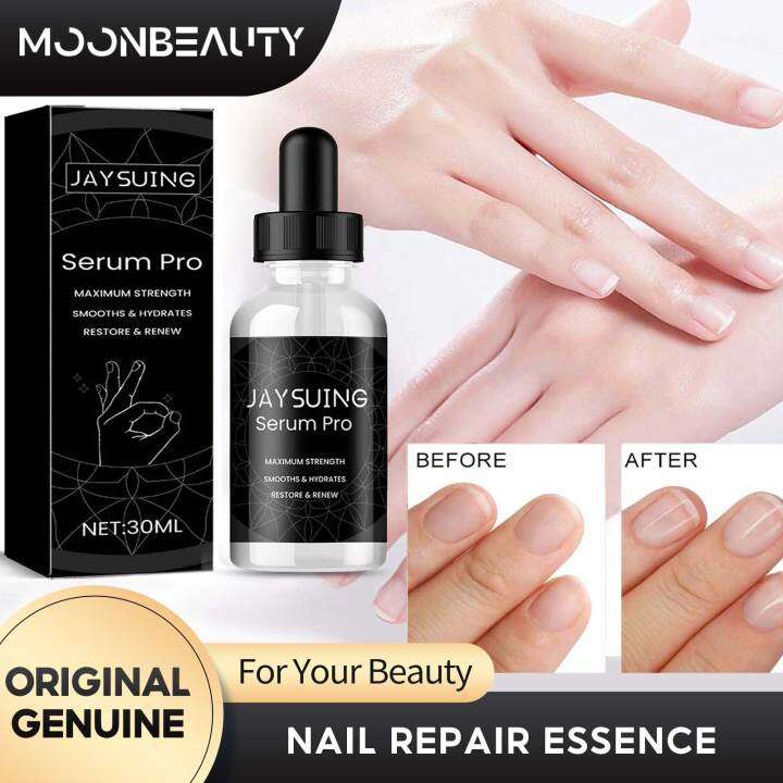 Jaysuing Fungus Nail Care Oil Nail Fungal Removal Oil Toe Nails Fungal