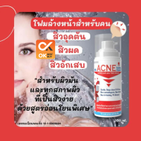 แมคไครม์ แอนตี้ แอคเน่ โฟมมิ่ง คลีนเซอร์ ปัญหา สิว MCK Anti-Acne Foaming Cleanser 150 ml (วันหมดอายุ 15/2/26)