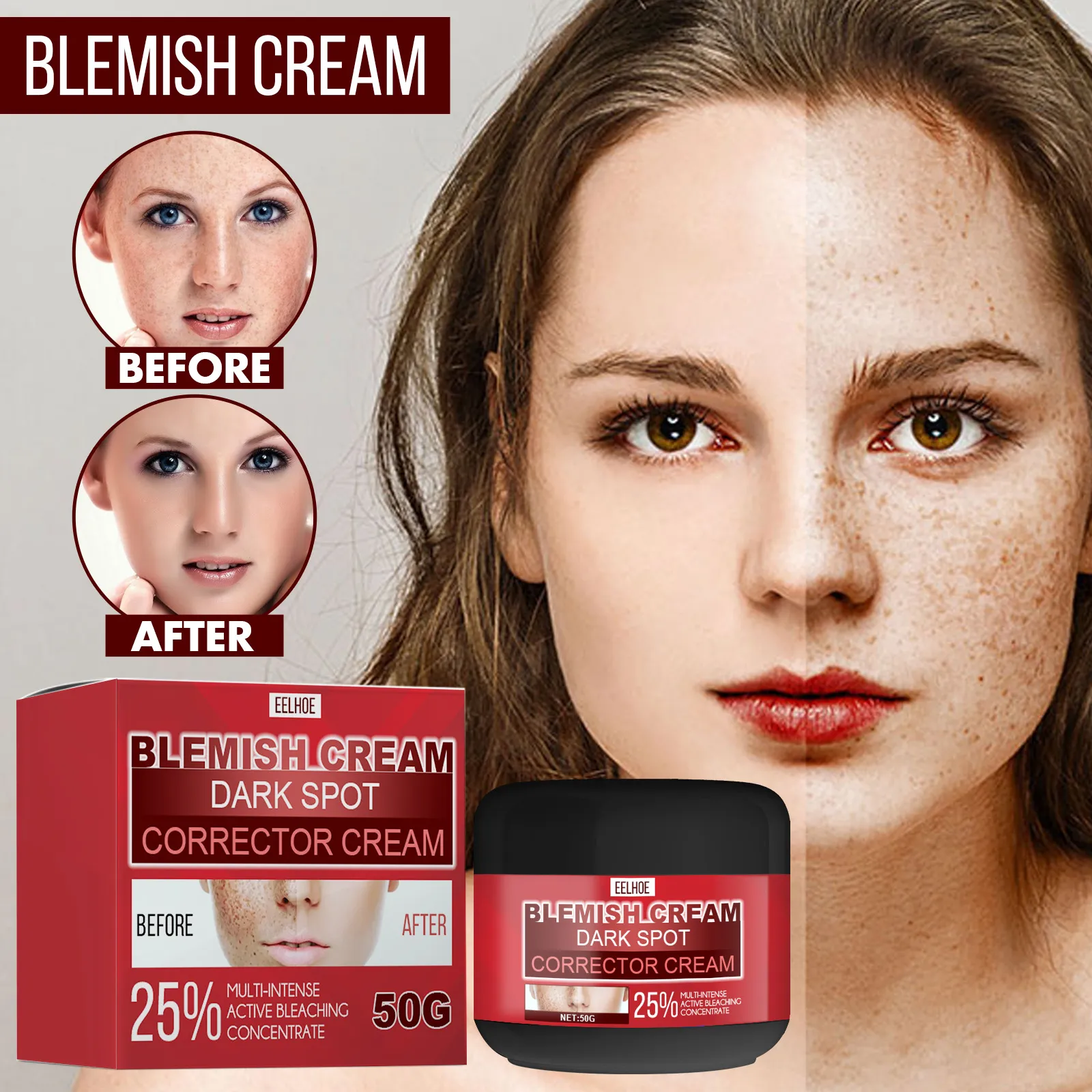 Eelhoe Dark Spot Correction Cream Anti-Aging Whitening Moisturizing  Anti-Freckle Cream Remove Melasma Acne Spot Repair Melanin Dark Spots  Pigmentation Moisturizing Gel Skin Care（50g） | Lazada Singapore