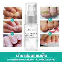 จัดส่งทันที น้ำยารักษาเล็บ 20ml    เล็บเกิดใหม่สวยเหมือนเดิม   เล็บมือ เล็บเท้าใช้ได้หมด  AuQuest น้ำยาทาเล็บ  น้ำยาแก้เล็บเสีย   เซรั่มทาเล็บเสีย   ยาทาเชื้อราที่เล็บ ทำให้เล็บดีขึ้น  ยาทาแก้เชื้อราที่เล็บ  ช่วยลดเชื้อราที่เล็บมือ