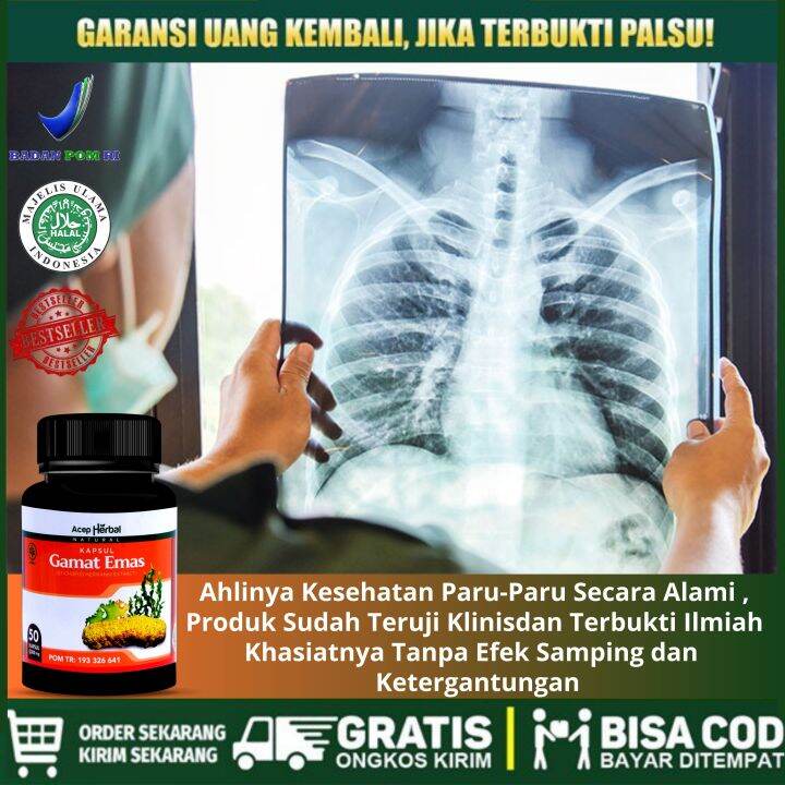 Spesialis Obat Untuk Penyakit Paru Paru Asma TBC Tuberculosis Batuk ...