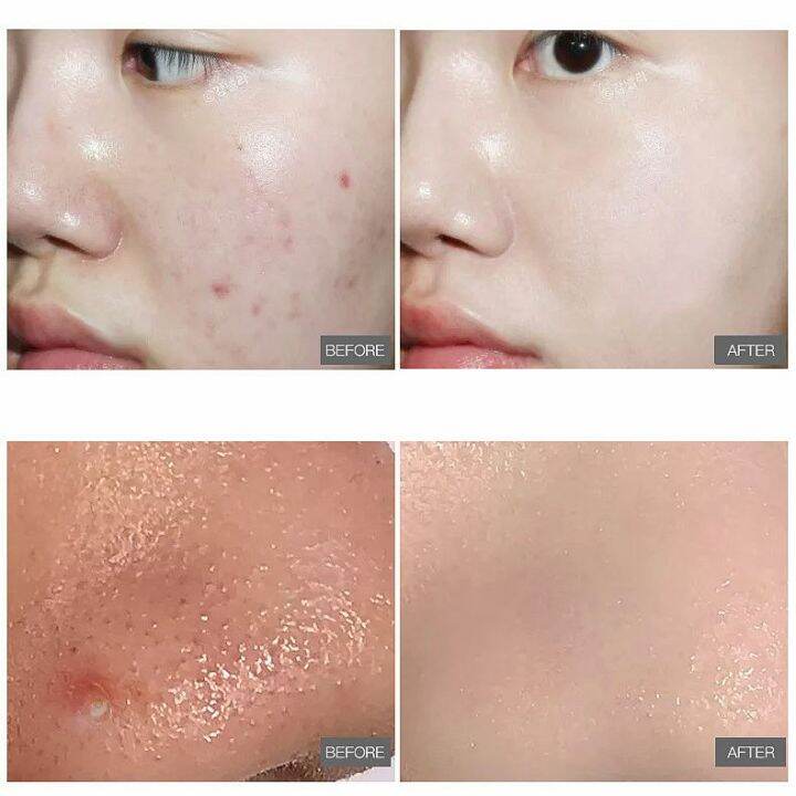 Dry skin, turning red, personal care, shrinking pores, whitening skin, maintaining moisture