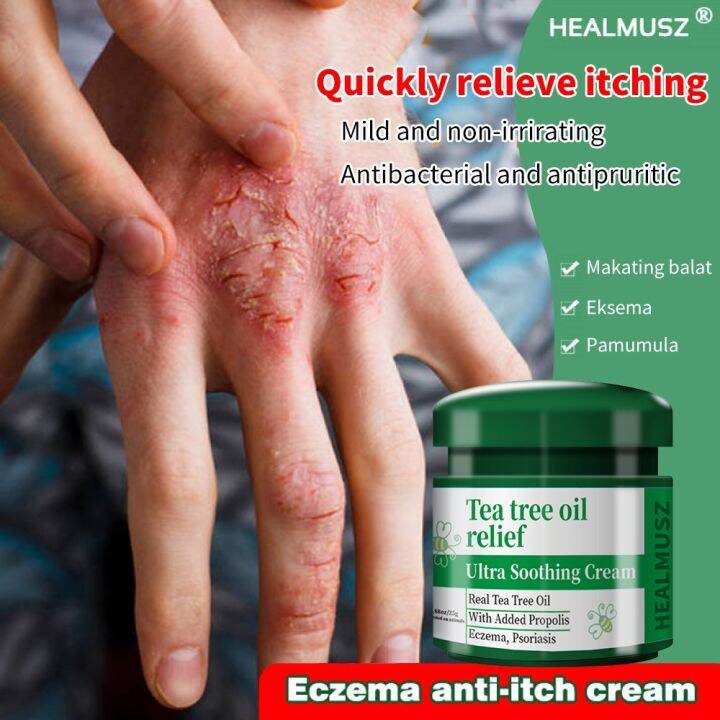 Antibacterial Eczema Cream Effective Itching Sweat Herpes Treatment