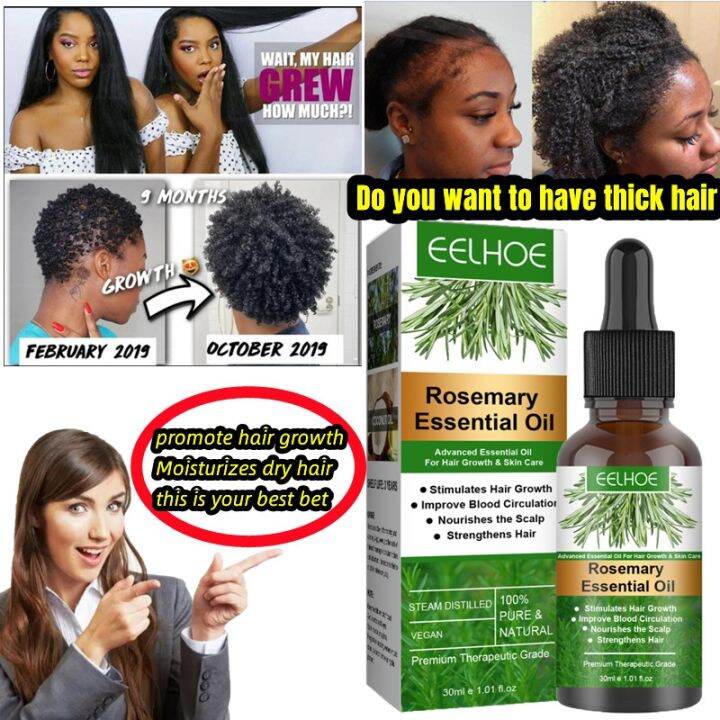 【CW】 Rosemary Hair Care Essential Oil Alopecia Treatment Anti Hairs
