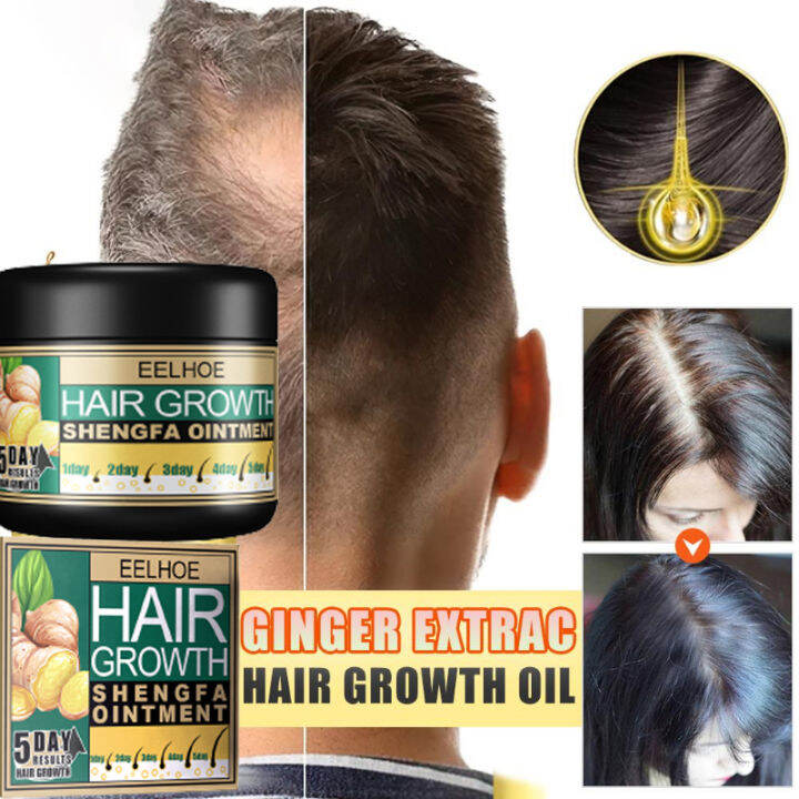 Eelhoe 5 Days Ginger Hair Growth Care Ointment Hair Fast Regrowth