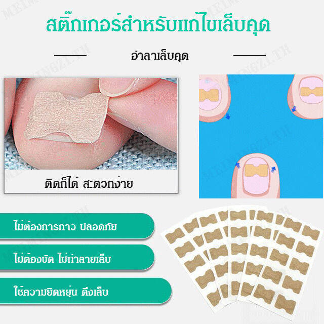 meimingzi-ชุดสติ๊กเกอร์สำหรับแก้ไขเล็บคุด