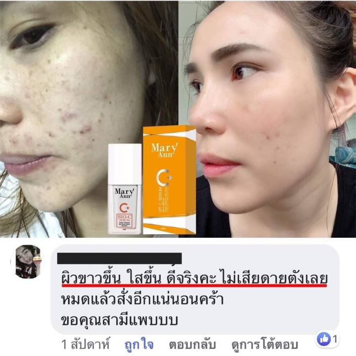 เซรั่มมารีแอน-3-ขวด-เซรั่มวิตซี-ขนาด-20-ml-ราคา-600-บาท