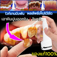 ⚡️เอาหินปูนออกใน 1 วินาที น้ำยากำจัดหินปูน30ML ขจัดคราบหินปูน น้ำยากำจัดหินปูน ยาสีฟันฟอกฟันขาว กําจัดนิ่วในฟัน ยาสีฟันฟันขาว ซ่อมฟันเหลือง ฟันขาวขึ้น น้ำยาขัดฟันขาว หินปูน Dental stone spray