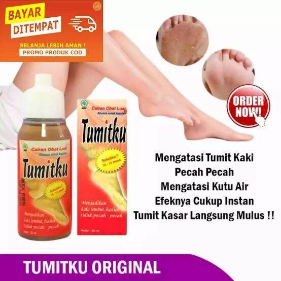 Bayar Di Tempat Tumitku Mengatasi Kulit Kapalan Dengan Instan Dan Cepat