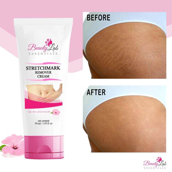 BEAUTY LAB ESSENTIALS STRECHMARK REMOVER Scar Remover Peklat scar