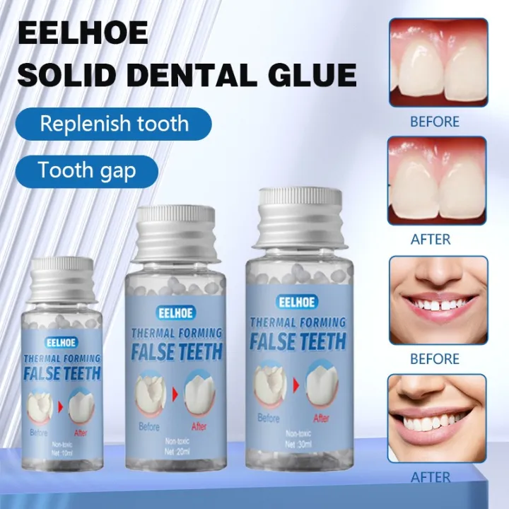 MOFE Denture Adhesive Glue Temporary Tooth Repair Kit Moldable False