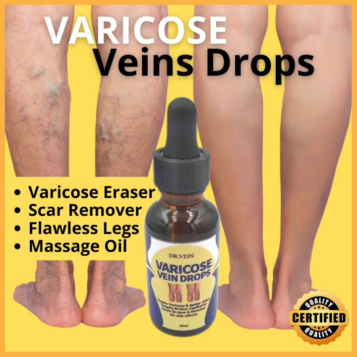 (BEST FOR VARICOSE VEINS) NOW AVAILABLE!!! Authentic & Effective DR