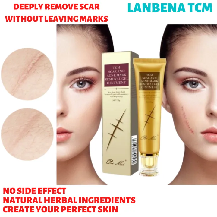 👄authentic Lanbena Tcm Scar And Acne Mark Removal Gel Ointment 30g 