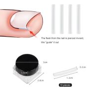 10pcs Ingrown Toenail Correction Tool Ingrown Toe Nail Treatment Elastic Patch Sticker Straightening Clip Brace Pedicure Tool