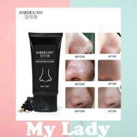 Mylady AUQUEST ANKFOUAN removing BLACK HEAD Face Mask