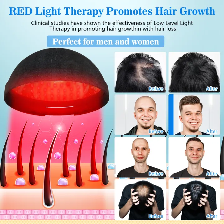 KTS Hair Regrowth Cap Hair Care Device for Women LED Hat for Hair Loss